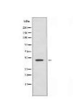 UBR1 Antibody