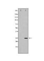UCHL1 Antibody