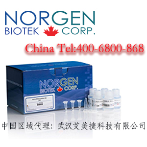 血浆/血清循环核酸纯化小提试剂盒（提取试剂盒）