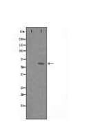 YTHDF1 Antibody