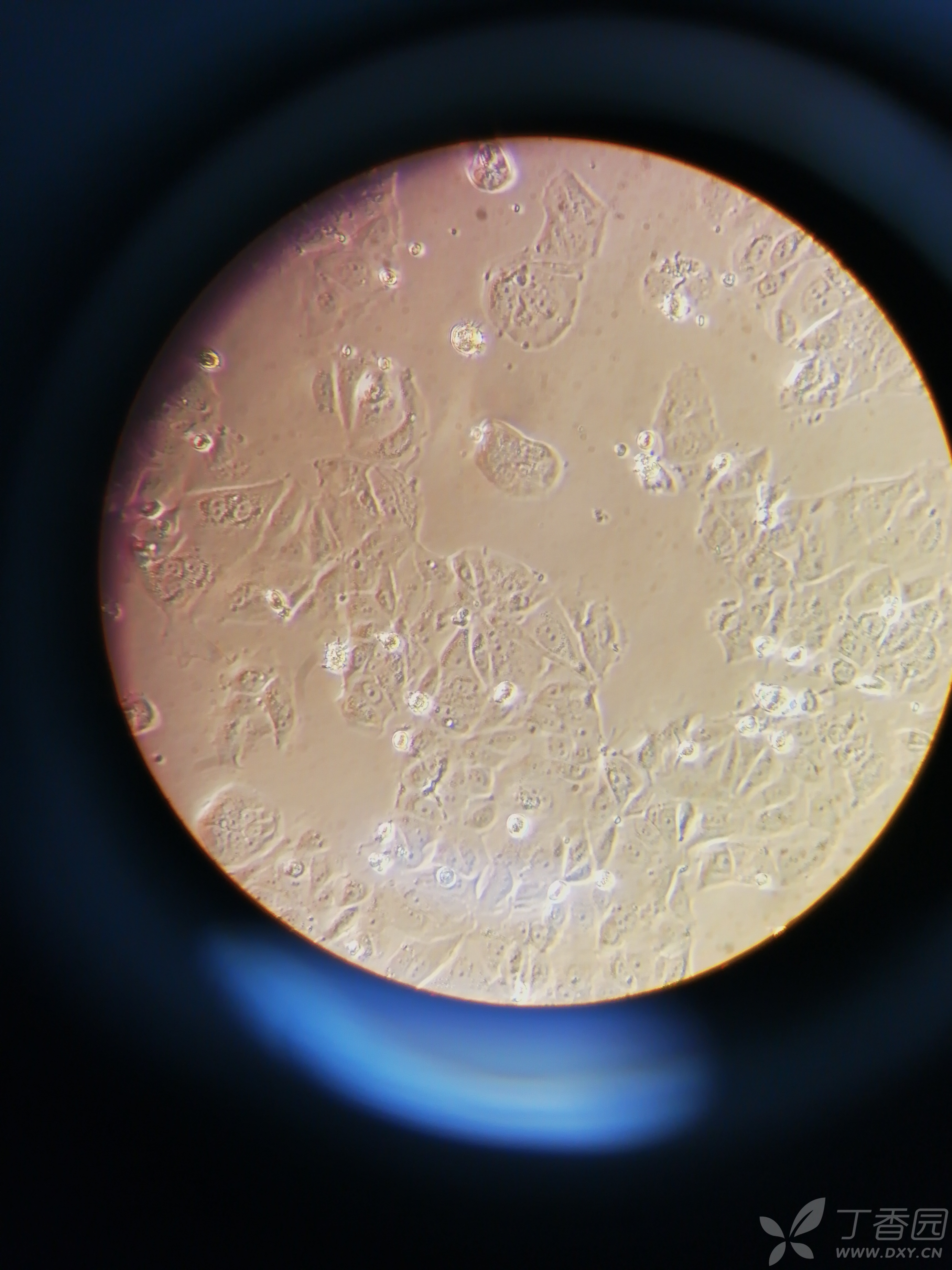 我的mcf-7人乳腺癌细胞形态正常不?