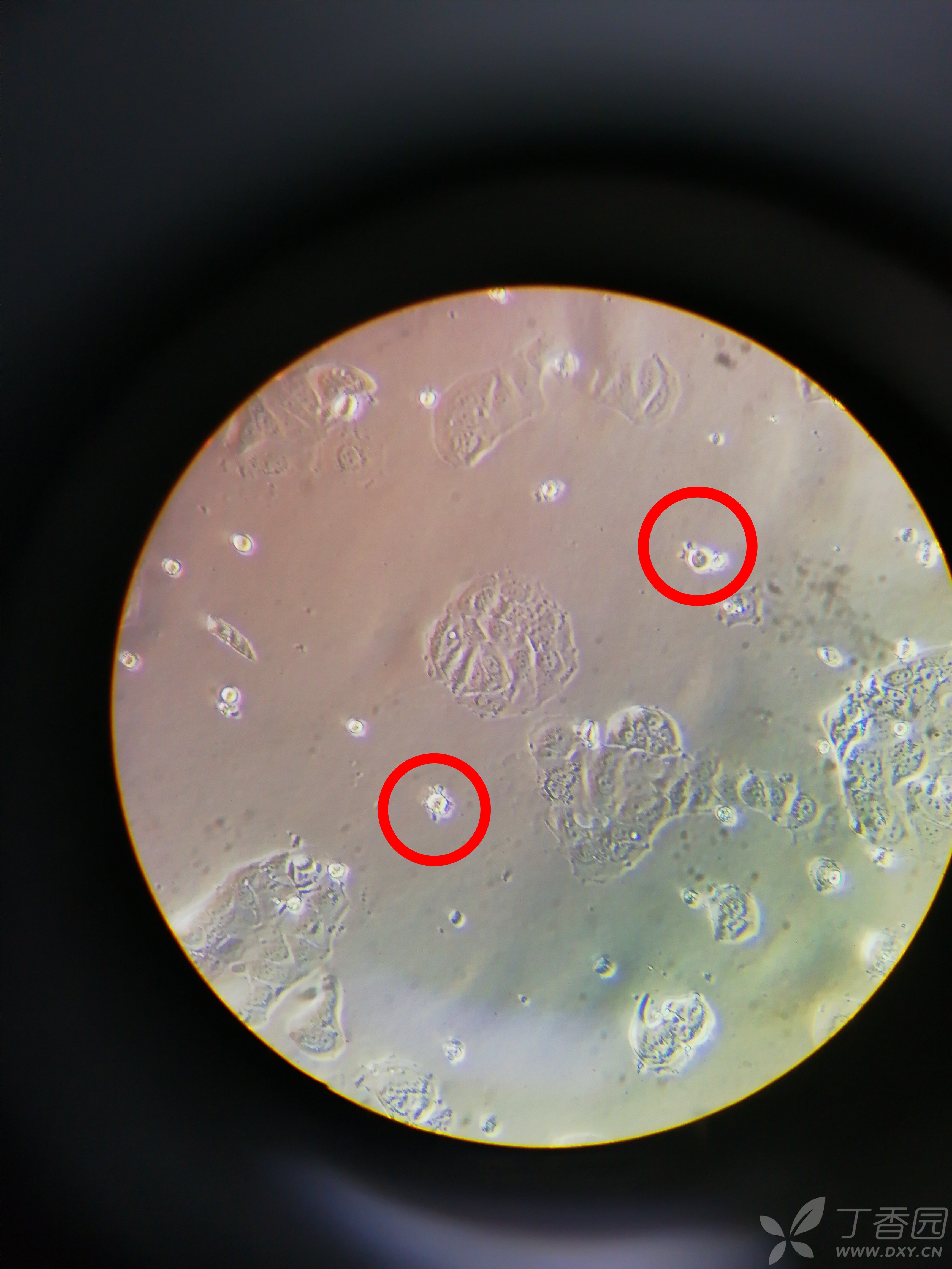 我的mcf-7人乳腺癌细胞形态正常不?
