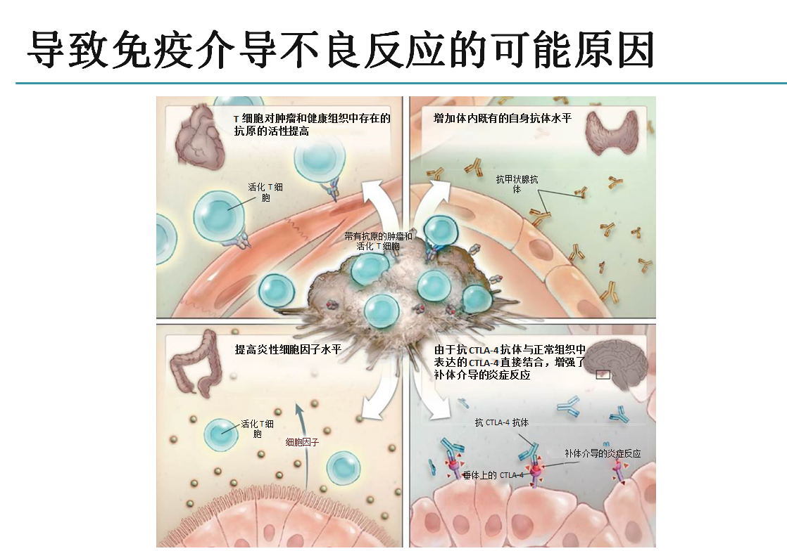 免疫介导不良反应的临床治疗建议:累及中枢神经系统