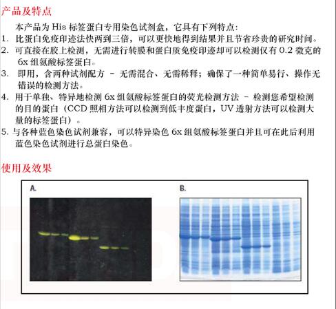组氨酸标签蛋白染色试剂盒10 次品牌