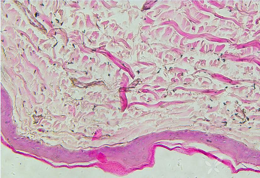 求大神帮忙指导------大鼠皮肤he染色图