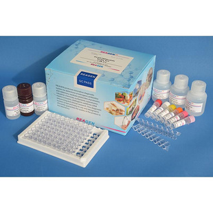 人OJ抗体/抗异亮氨酰tRNA合成酶抗体(OJ/IleRS)ELISA试剂盒 