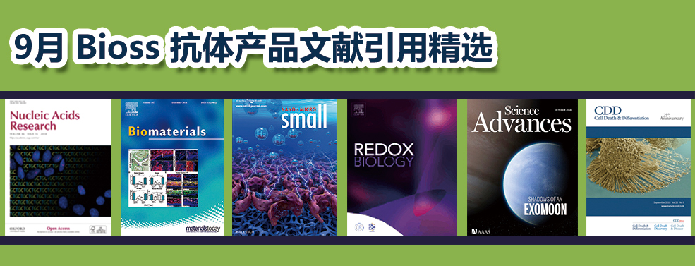 文献调研｜2018年9月Bioss抗体产品文献引用精选