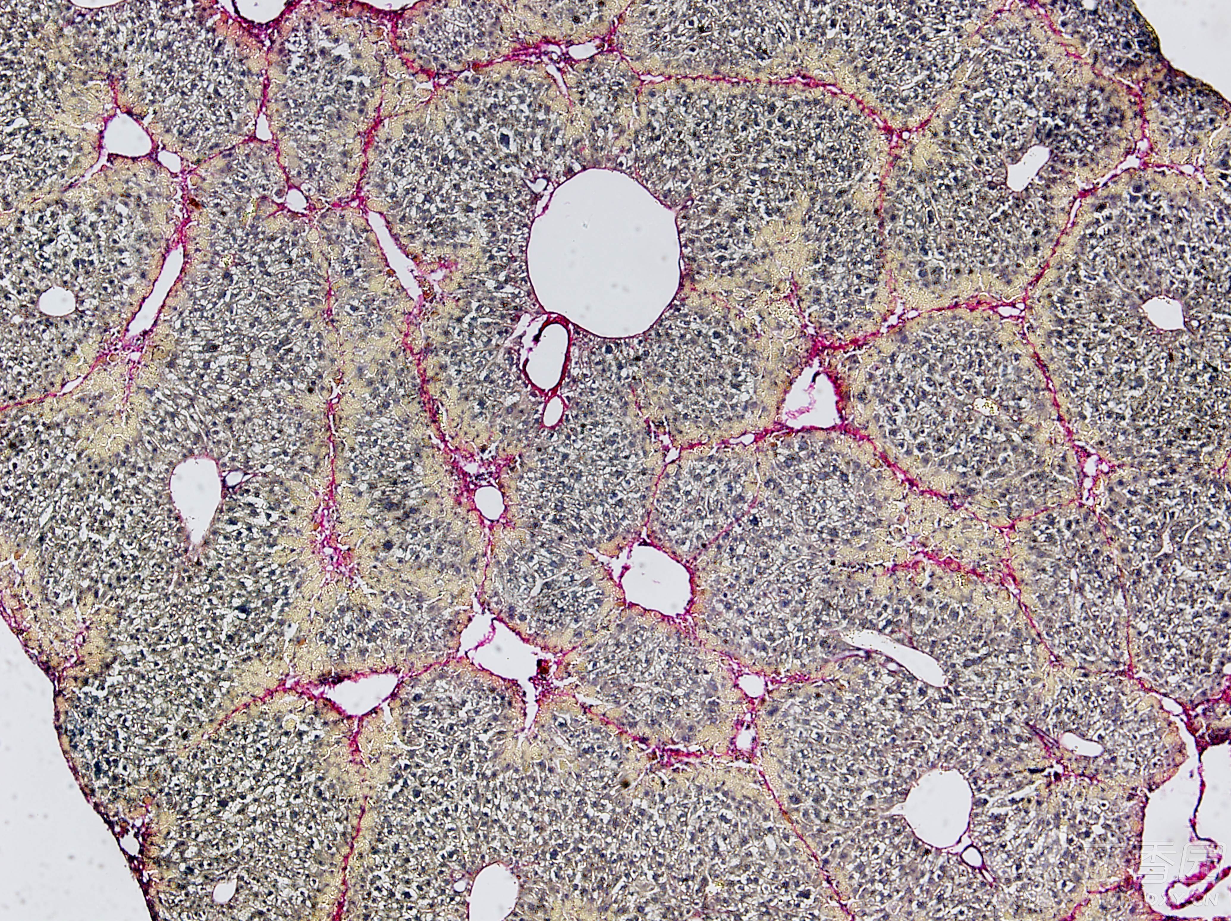 肝纤维化天狼星红染色被染上黄色的是什么 生理生化与组织胚胎