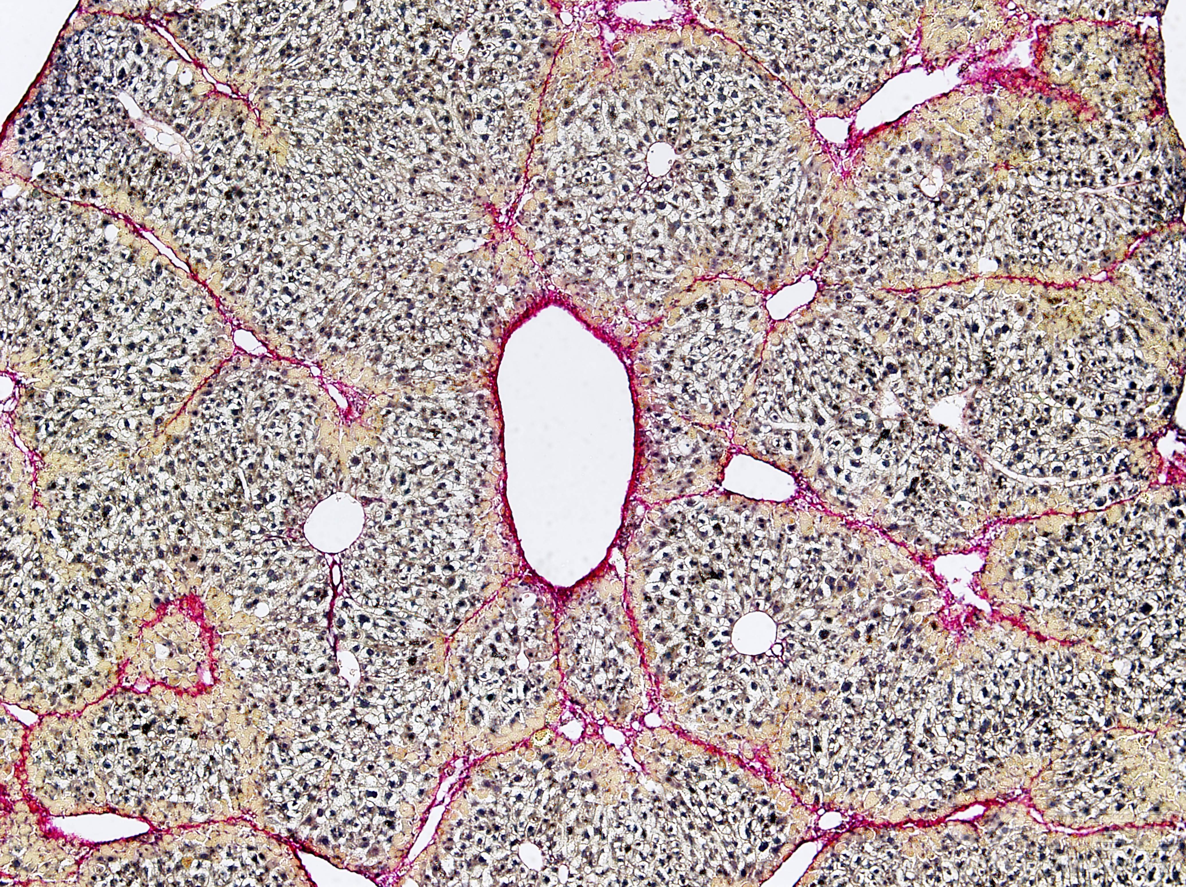 肝纤维化天狼星红染色被染上黄色的是什么 - 生理生化与组织胚胎 - 专
