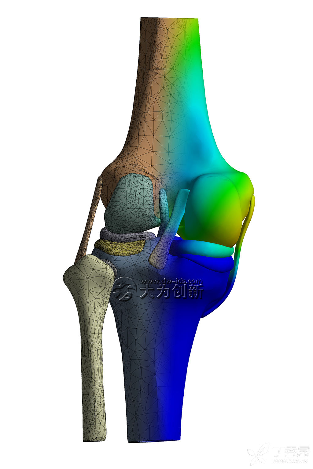 通过建立膝关节的完整模型,分析膝关节半月板部分切除后,膝关节骨骼的