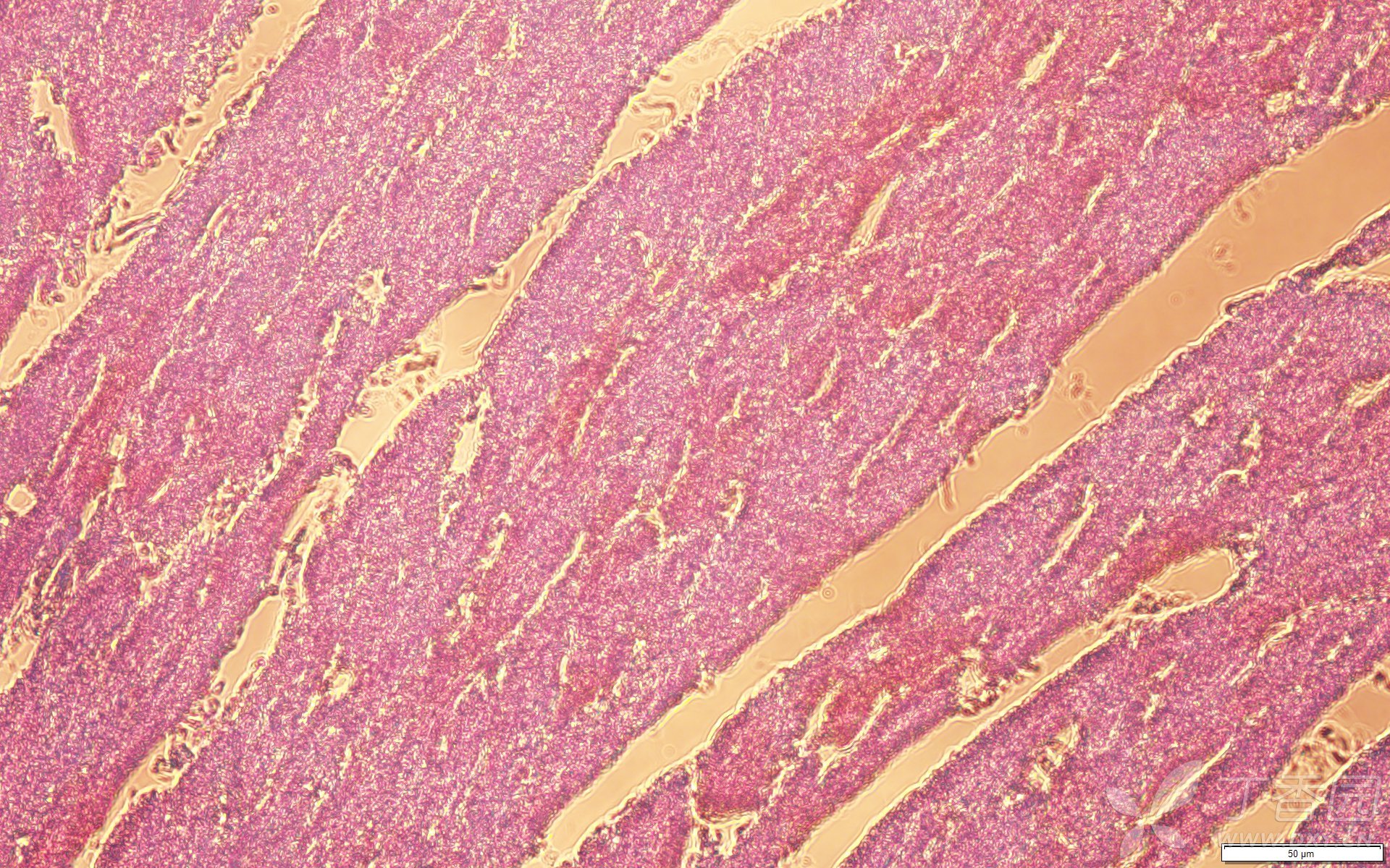 【求助】求大鼠心肌梗死造模成功后的he染色图片!大家帮帮忙,急!