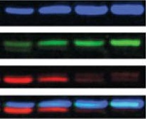 蛋白质印迹/Western Blot