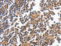 Anti-MAGEA4 antibody