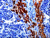 Anti-EPHX1 antibody