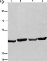Anti-RBMY1A1 antibody