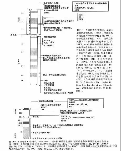 病例剖析 从年轻女性原发性闭经 矮小症伴脊柱关节炎细说 先天性卵巢发育不全症