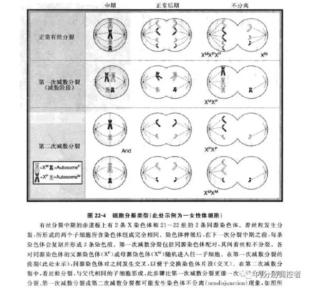 病例剖析 从年轻女性原发性闭经 矮小症伴脊柱关节炎细说 先天性卵巢发育不全症