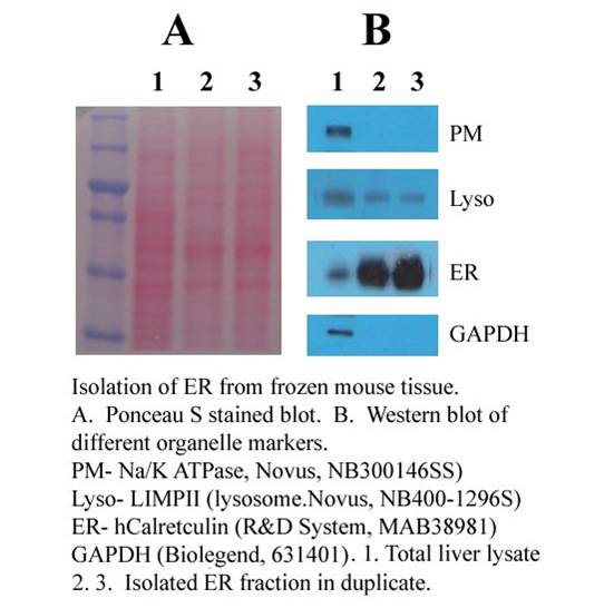 【新品抢先看】细胞器互作，蛋白转运研究样品分离新工具！