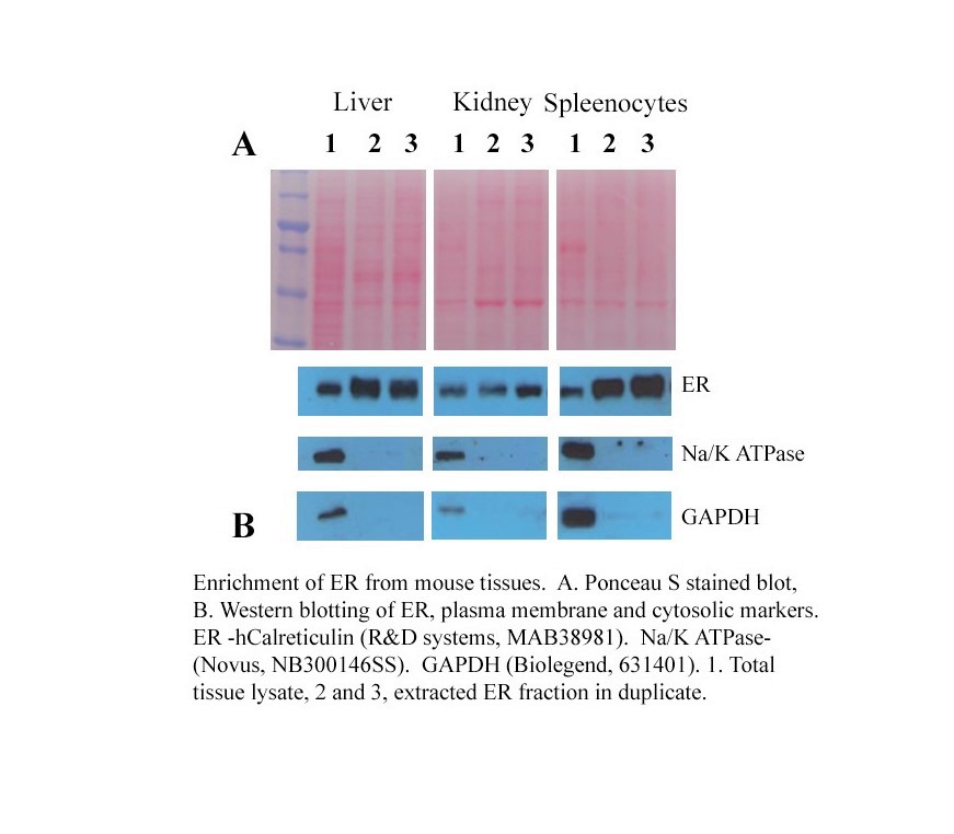 ER-G-F copy.jpg 【新品抢先看】细胞器互作,蛋白转运研究样品分离新工具!