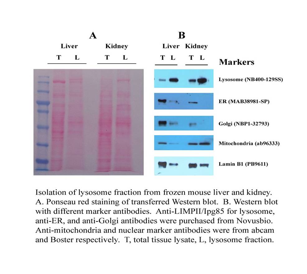 【新品抢先看】细胞器互作，蛋白转运研究样品分离新工具！