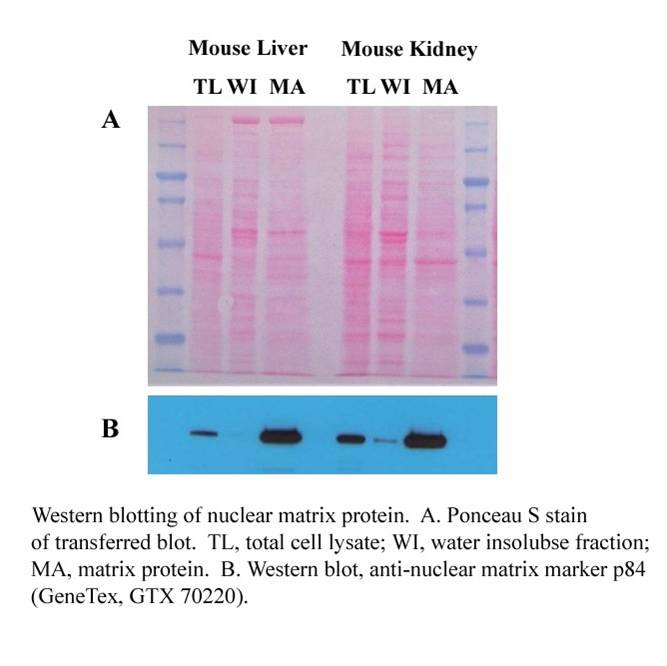 【新品抢先看】细胞器互作，蛋白转运研究样品分离新工具！