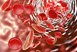 诺华 Promacta 获 FDA 批准用于再生障碍性贫血