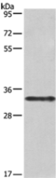 Anti-IL1A antibody