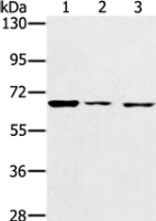 Anti-IGF2BP3 antibody