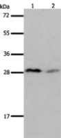 Anti-KLK7 antibody