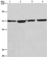 Anti-KLF11 antibody