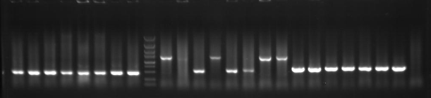 科研集市-16丨菌落PCR，进来瞄一眼，你不会后悔的