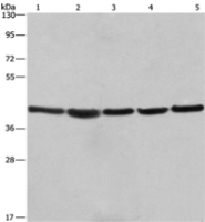 Anti-RPSA antibody