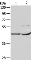 Anti-NCEH1 antibody