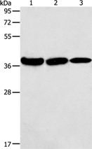 Anti-AGA antibody