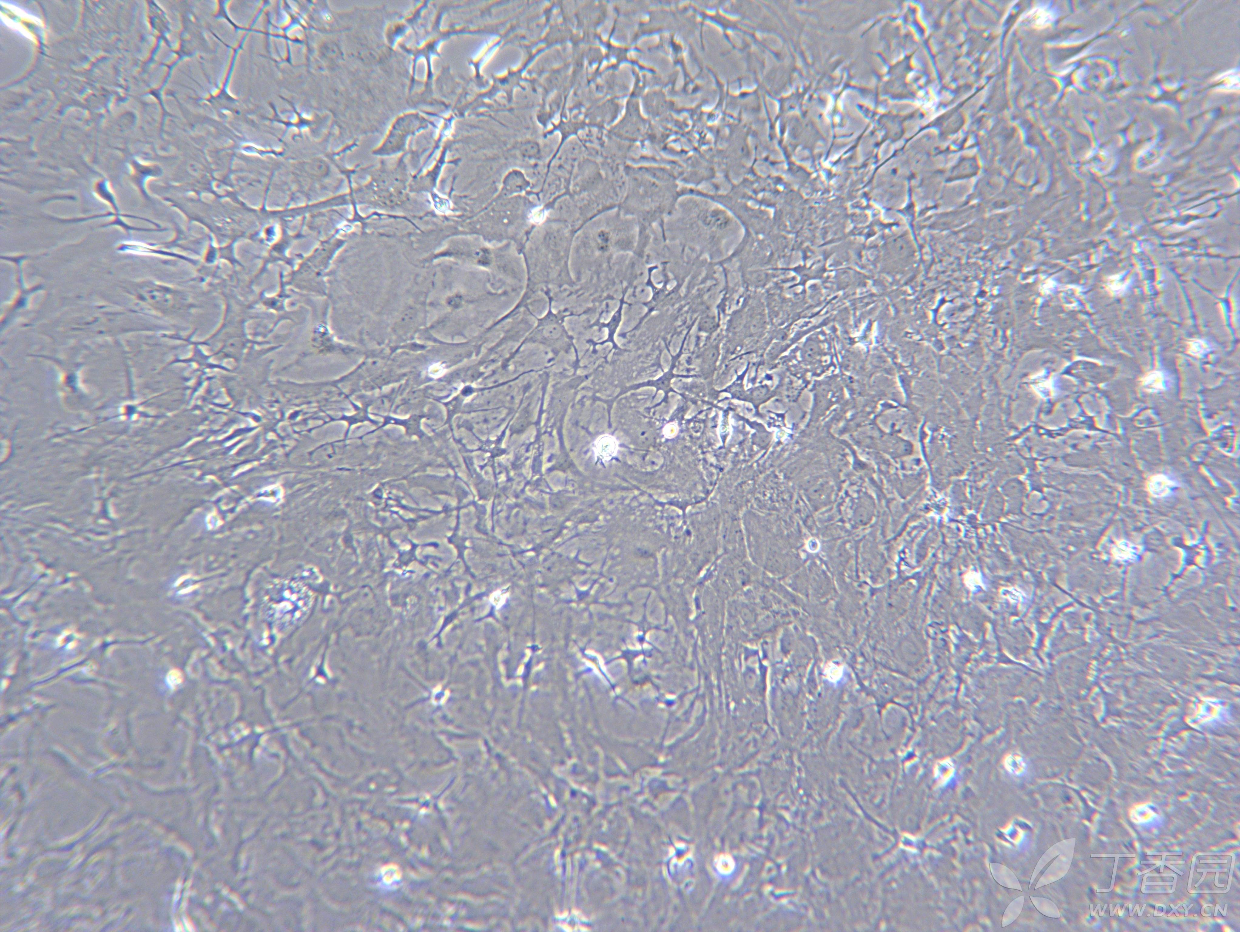 星形胶质细胞传代