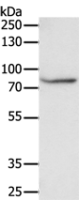 Anti-F13A1 antibody