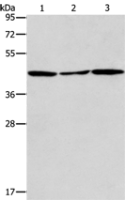 Anti-ACAA2 antibody