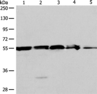Anti-NAMPT antibody