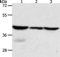 Anti-CAPG antibody