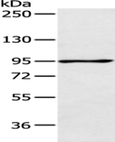 Anti-AGBL2 antibody