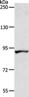 Anti-ACAD11 antibody
