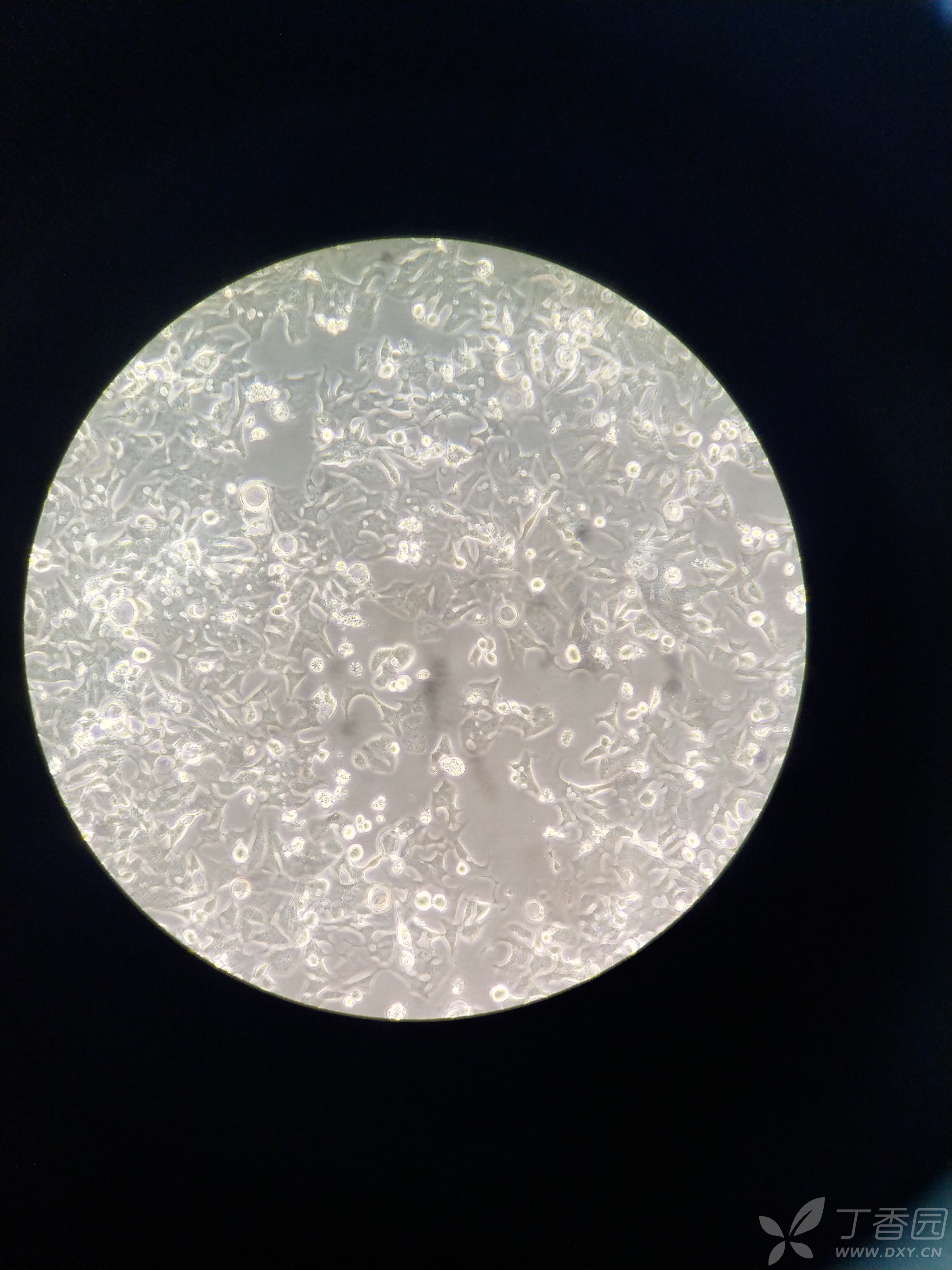 skbr3细胞长出触角