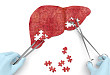 Medscape 精选 | 中国正在征服慢性乙型肝炎