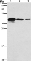 Anti-TWF2 antibody