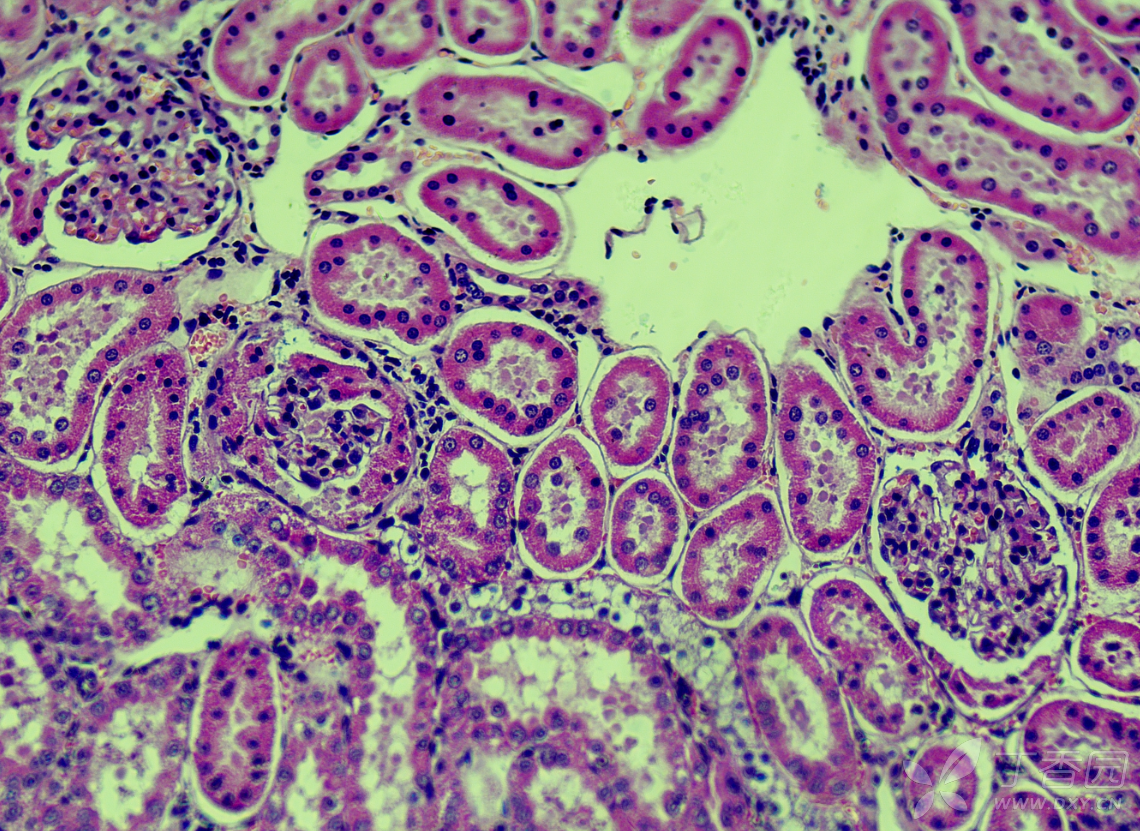 怎么看肾小球内皮细胞,系膜这些是不是增生了?肾小球是不是肥大?
