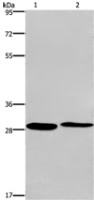 Anti-CPSF4 antibody