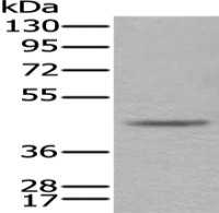 Anti-CAMK1D antibody