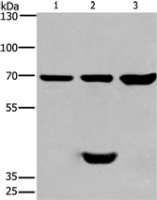 Anti-CABLES1 antibody