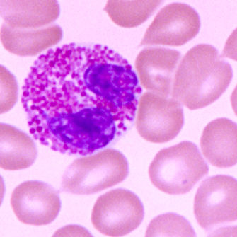 人胰腺MatchPair™:胰腺上皮细胞和肿瘤原代细胞【HumanPancreasMatchPair™:NormalHumanPancreaticEpithelialCellsandPancreaticCarcinomaCells】产品图