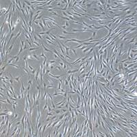 人脂肪间充质干细胞